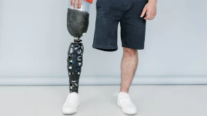Gaza Amputees Struggle Amid Shortages of Prosthetic Limbs