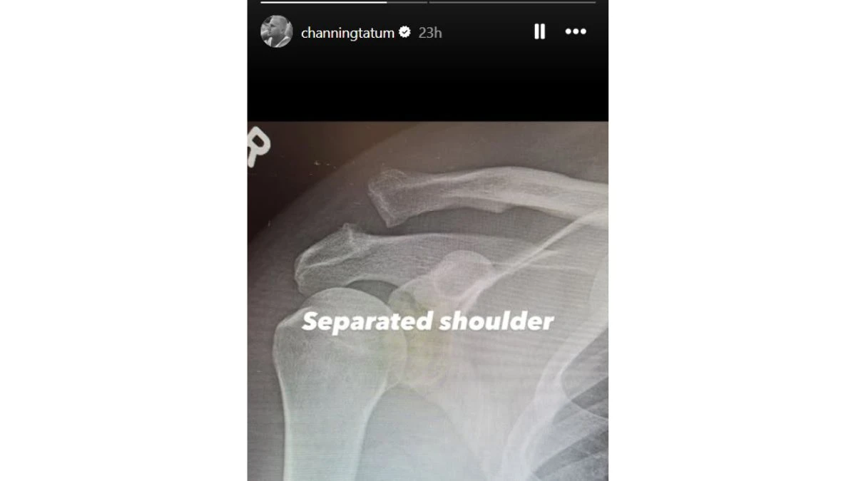 What Happened to Channing Tatum? Star Reveals Separated Shoulder Surgery After Hospital Instagram Update