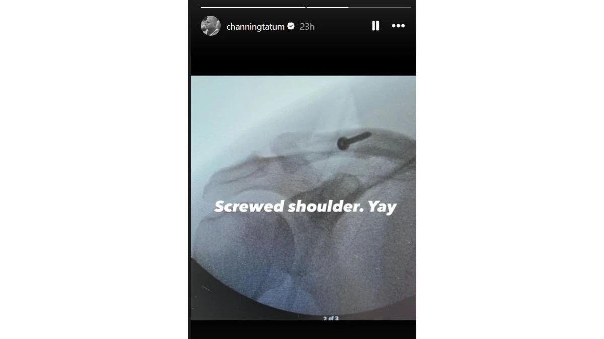 What Happened to Channing Tatum? Star Reveals Separated Shoulder Surgery After Hospital Instagram Update