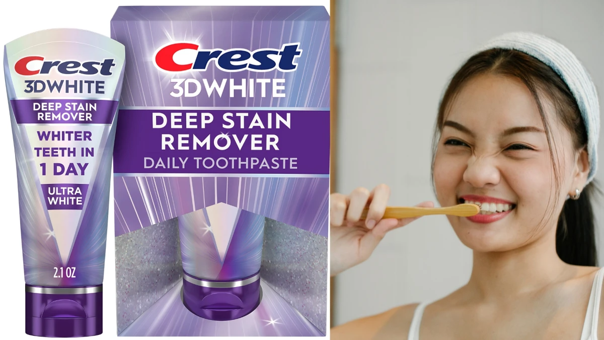 Top 10 Teeth Whitening Products of 2025 for Bright Smiles