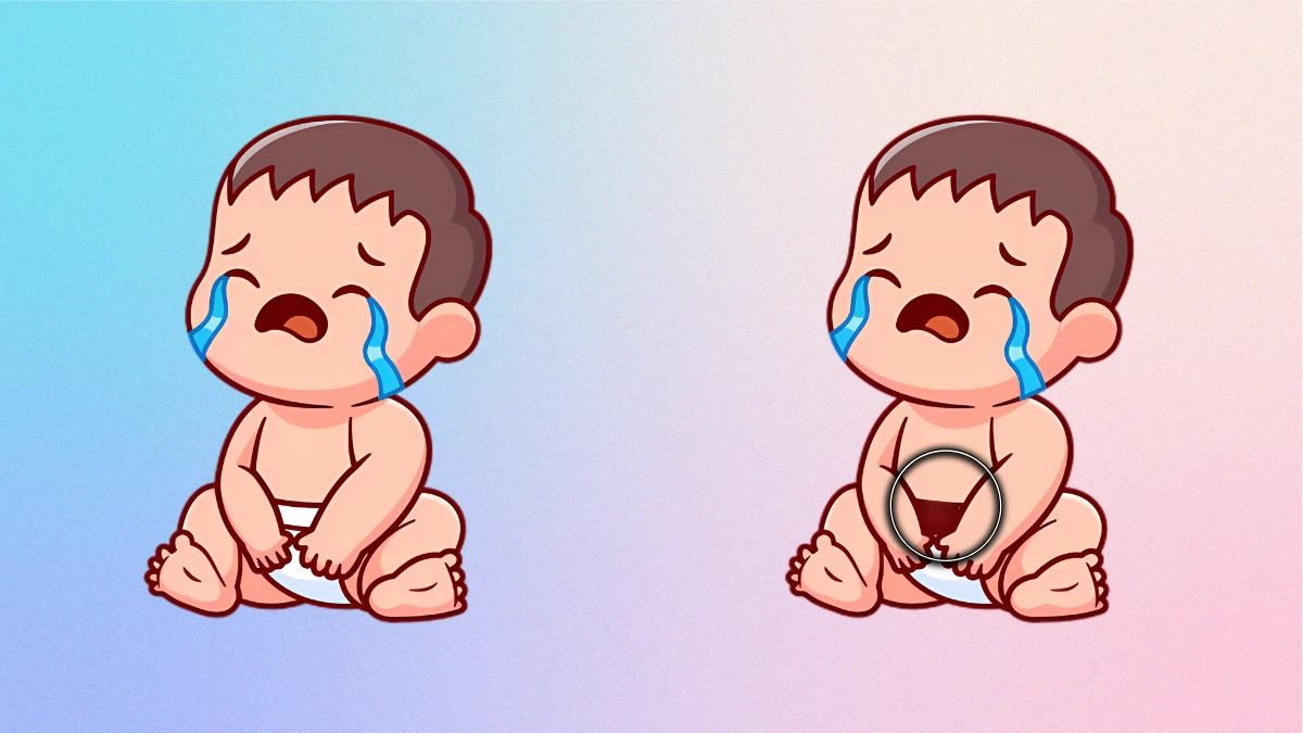 Find the Difference: Only 1% Can Spot The Difference in These Twin Images